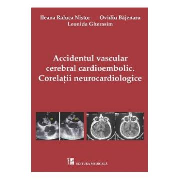 Accidentul vascular cerebral cardioembolic. Corelatii Neurocardiologice - Ileana Raluca Nistor
