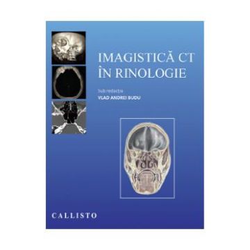 Imagistica CT in rinologie - Vlad Andrei Budu